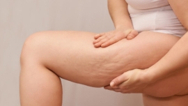 Terapia de Ondas Acústicas (AWT) para Tratar a Celulite e Textura da Pele