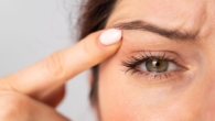 Tratamentos para Flacidez de Pálpebras Melhores Alternativas Sem Cirurgia