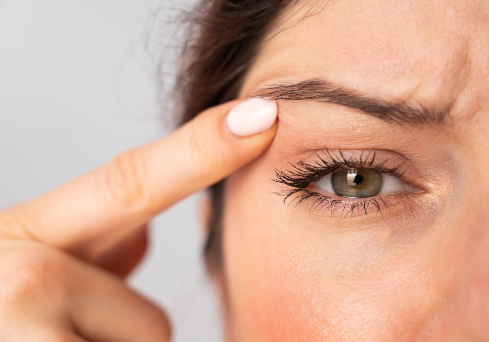 Tratamentos para Flacidez de Pálpebras Melhores Alternativas Sem Cirurgia